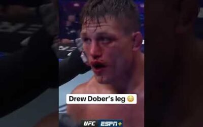 Drew Dober’s leg 😳 #UFCVancouver